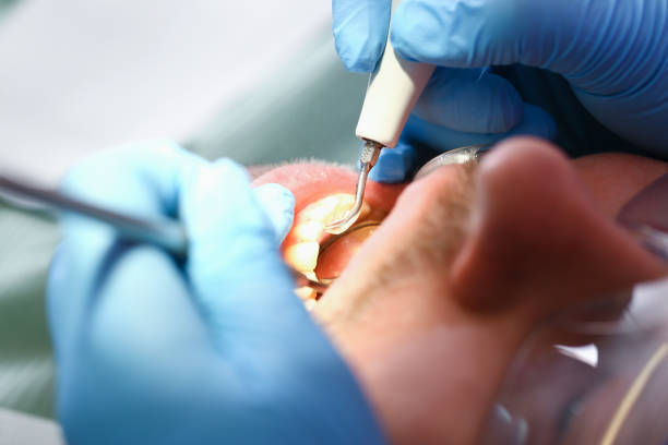 Best Emergency Broken Tooth Repair in Goshen, AR