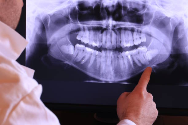Best Emergency Dental Surgery in Goshen, AR