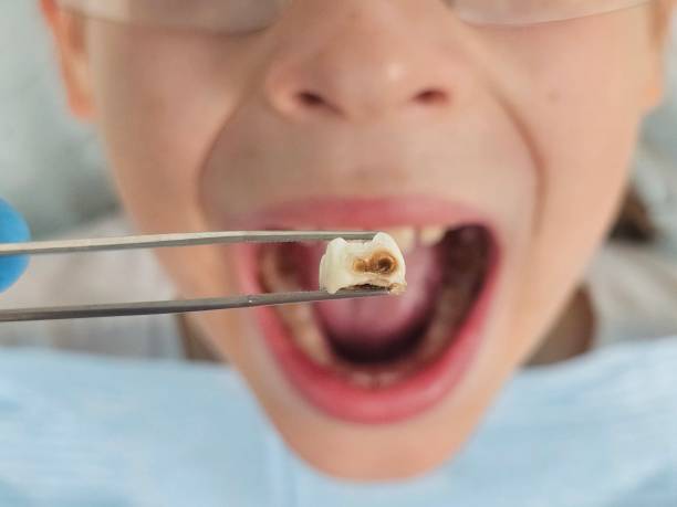 Best Emergency Treatment for Toothache in Goshen, AR
